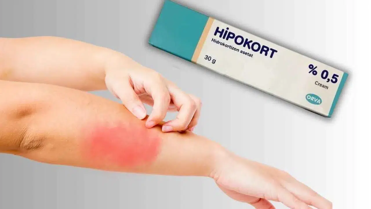 Hipokort krem ne işe yarar? Hipokort krem nedir, iltihap, kaşıntı ve kızarıklığa iyi gelir mi?