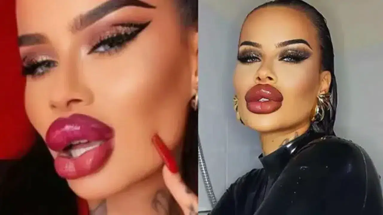 60 Bin Dolarlık Değişim, Fenomenin Dudak İtirafı Gündem Oldu