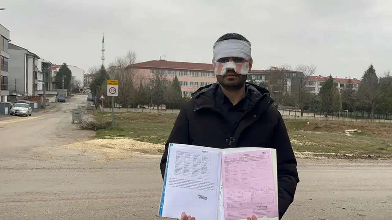 Serkan Keskinbaş’a ne oldu, sağlık durumu nasıl? Okulda sıcak çaylı saldırı iddiası