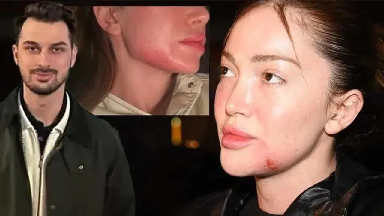 Berk Çetin mahkemede 'Pişmanım' dedi, ceza 5 ay hapis oldu!