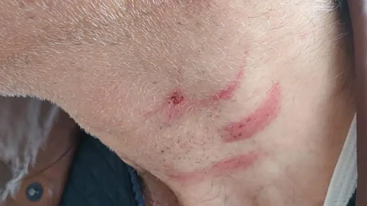 Konya’da Aile Hekimine Saldırı Olayı Nedir, Muayene Sırası Tartışması Sonrası Müezzin Yusuf Mete Neden Tutuklandı?