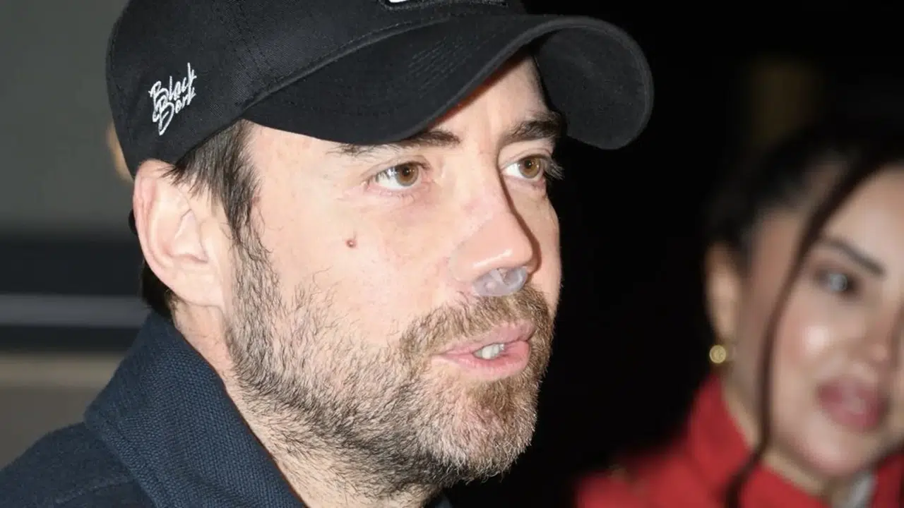 Murat Dalkılıç kaç kere burun estetiği yaptı? Ünlü şarkıcının burun ameliyatları ve yaşadığı sağlık süreci