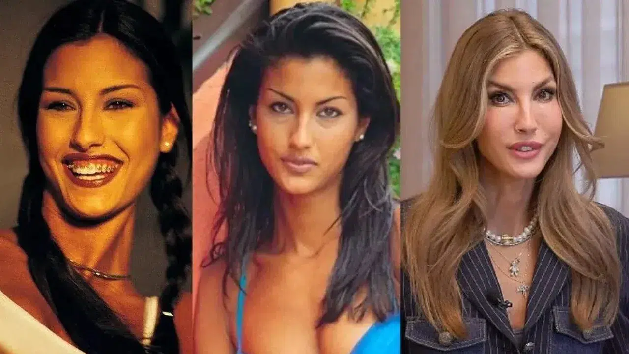 Çağla Şıkel eski hali nasıldı? Emre Altuğ sonrası yüzündeki değişim ve Nail Gönenli ile aşk dönemindeki son hali