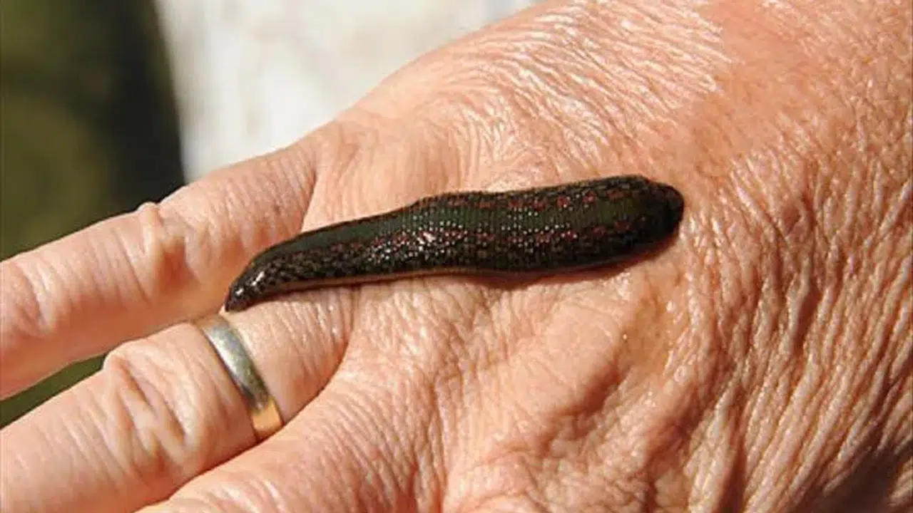 RÜYA SÜLÜK GÖRMEK NE ANLAMA GELİR! Sülük görmek iyi mi kötü mü, Rüyada ayağına sülük yapışması ne demek?