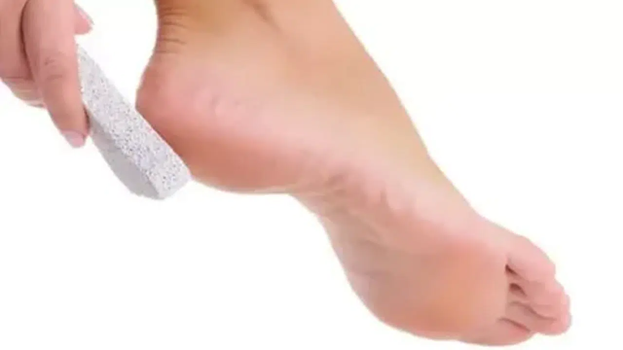 TOPUK ÇATLAKLARI NEDEN OLUR? Ne iyi gelir, evde nasıl tedavi edilir, yağlar işe yarar mı?