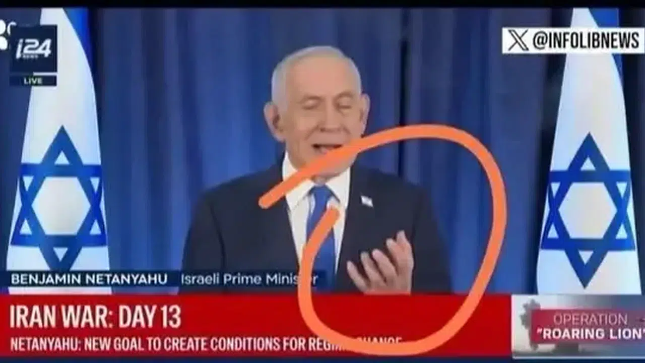 NETANYAHU ALTI PARMAKLI MI? Binyamin Netanyahu Öldü mü?