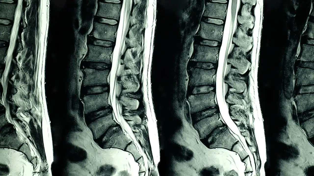İNTENSİTE NEDİR! Ne anlama gelir? Tıp, fizik ve sporda intensite ne demek?