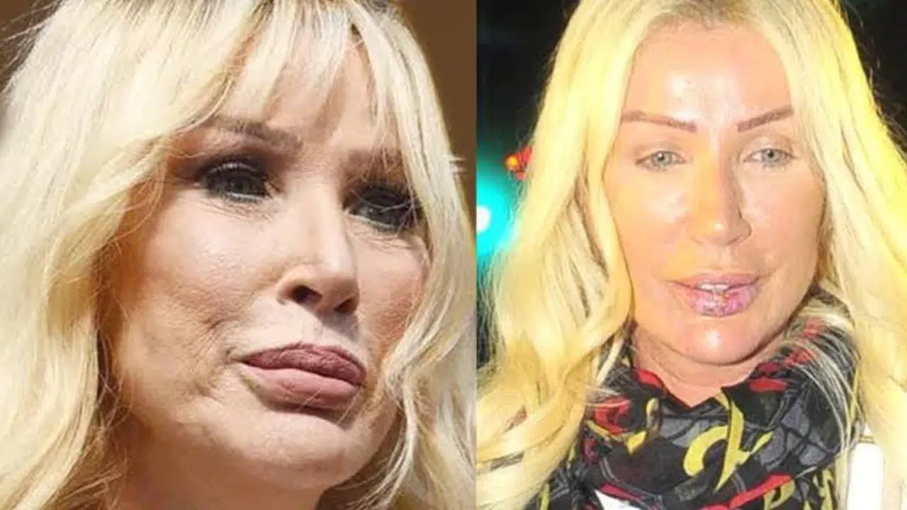 SEDA SAYAN KAÇ KERE ESTETİK YAPTIRDI! Neresinde ne estetiği var?