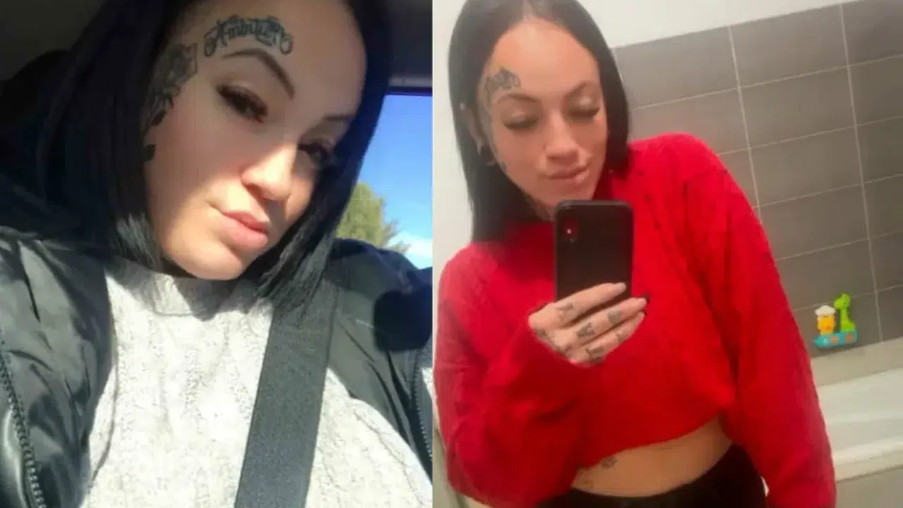 Estetik operasyon can aldı! Antalya’da 35 Yaşındaki Kanadalı Kadın Hayatını Kaybetti