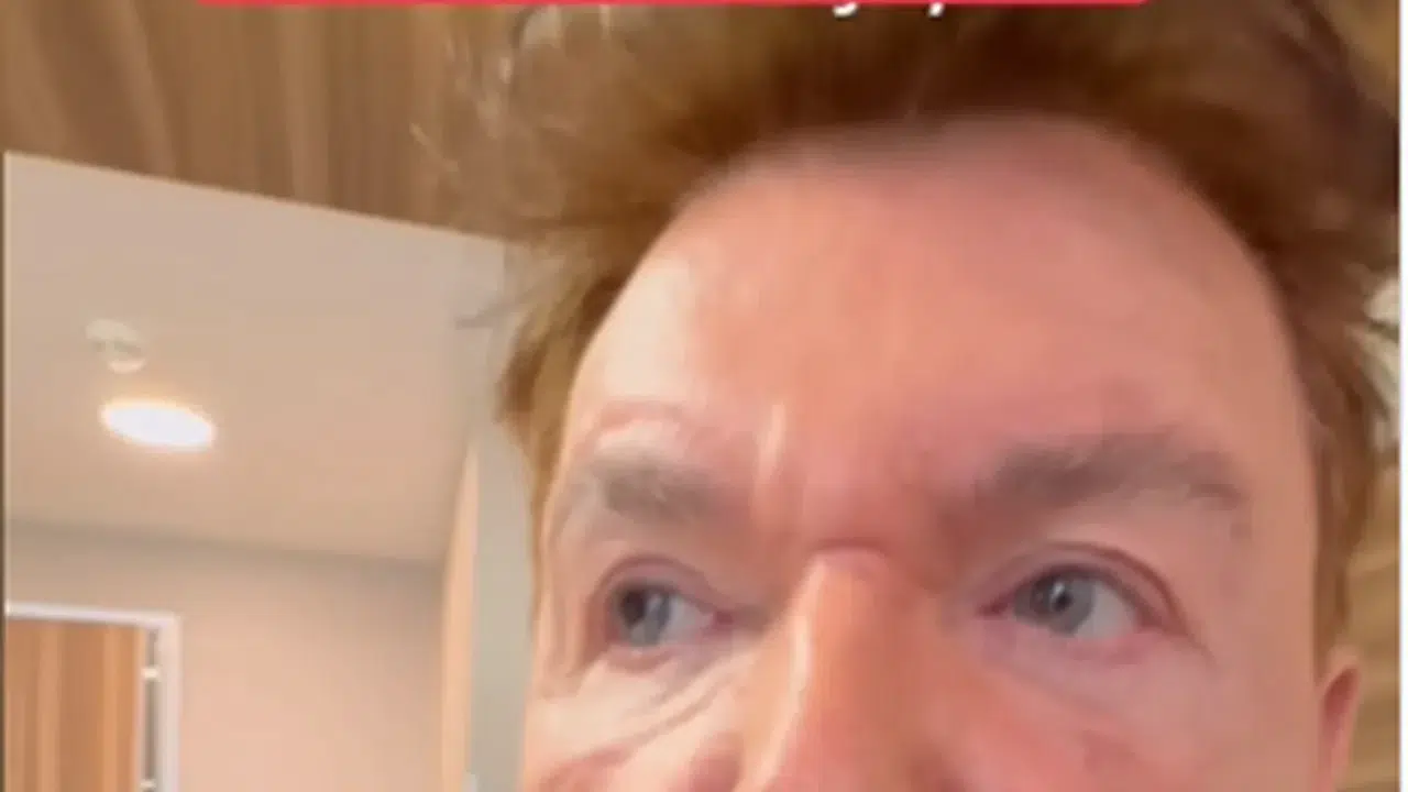 KUŞUM AYDIN SON HALİ, ESTETİK Mİ OLDU! Ameliyat Oldu Mu?