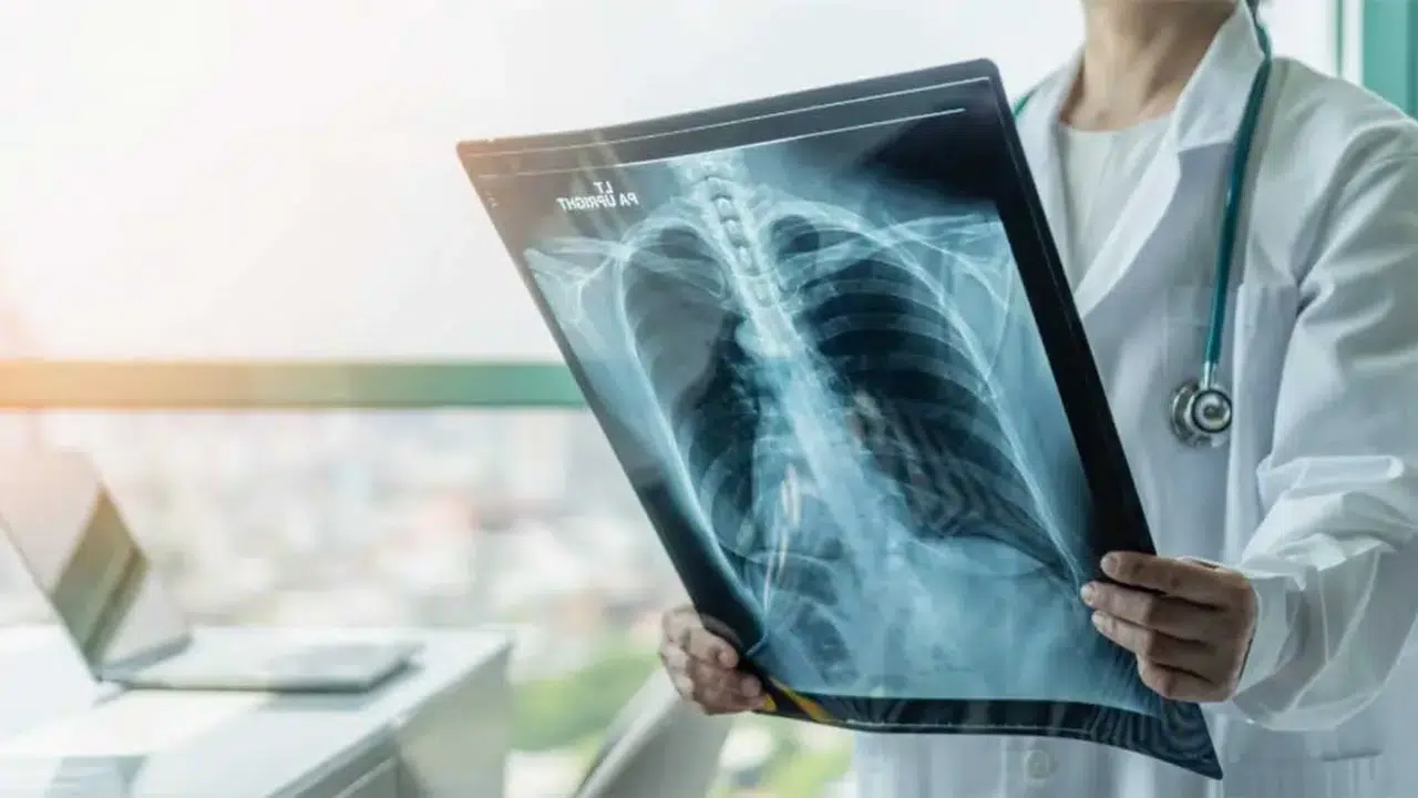 RADYOLOJİK KORELASYON TEDAVİSİ NEDİR? Nasıl uygulanır, neden önemlidir, hangi hastalıklarda kullanılır?