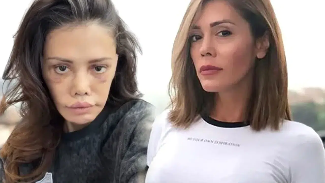 Didem Ceran’ın Operasyon Sonrası Görüntüsü Gündem Oldu