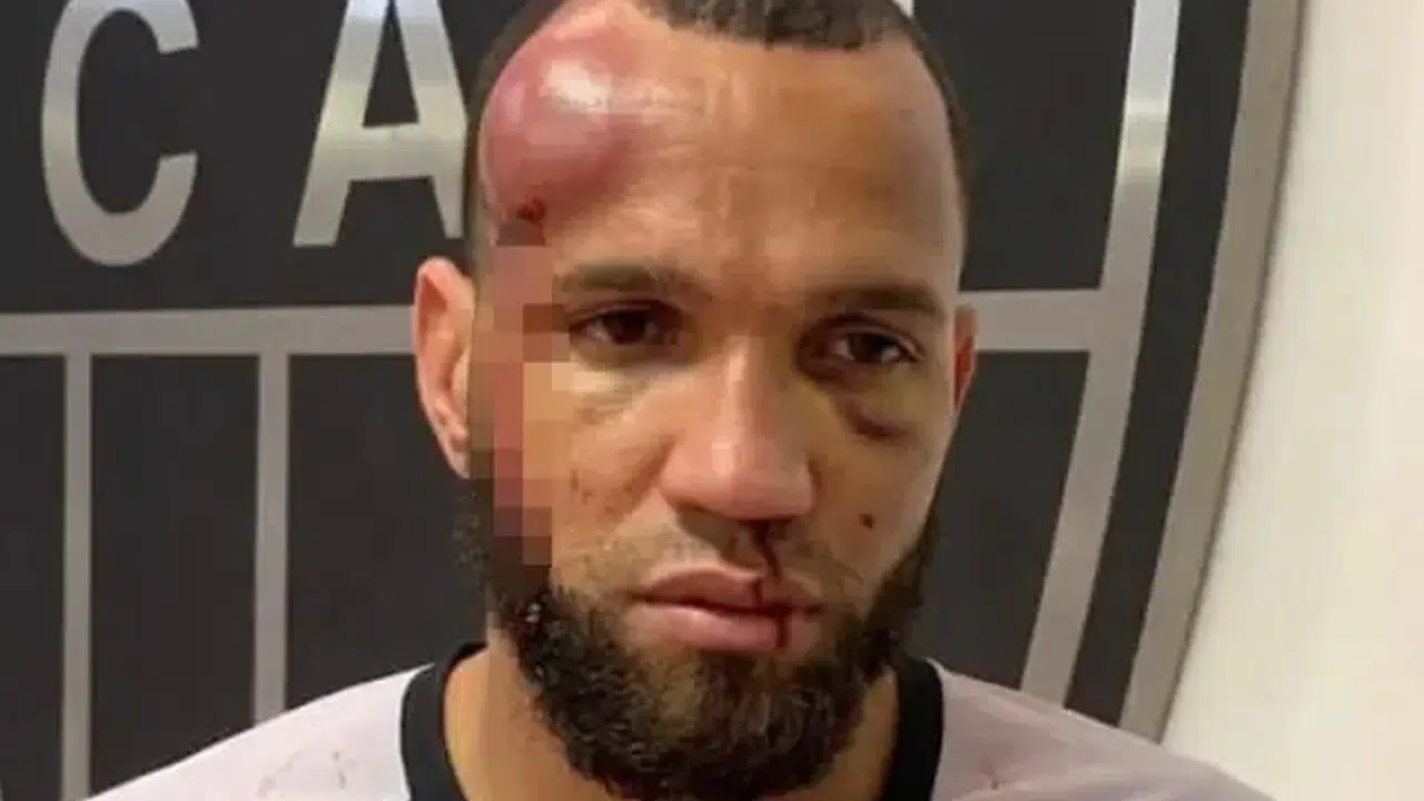 Brezilya’da Olaylı Derbi! Yumruklar Havada Uçuştu, Maç Savaş Alanına Döndü