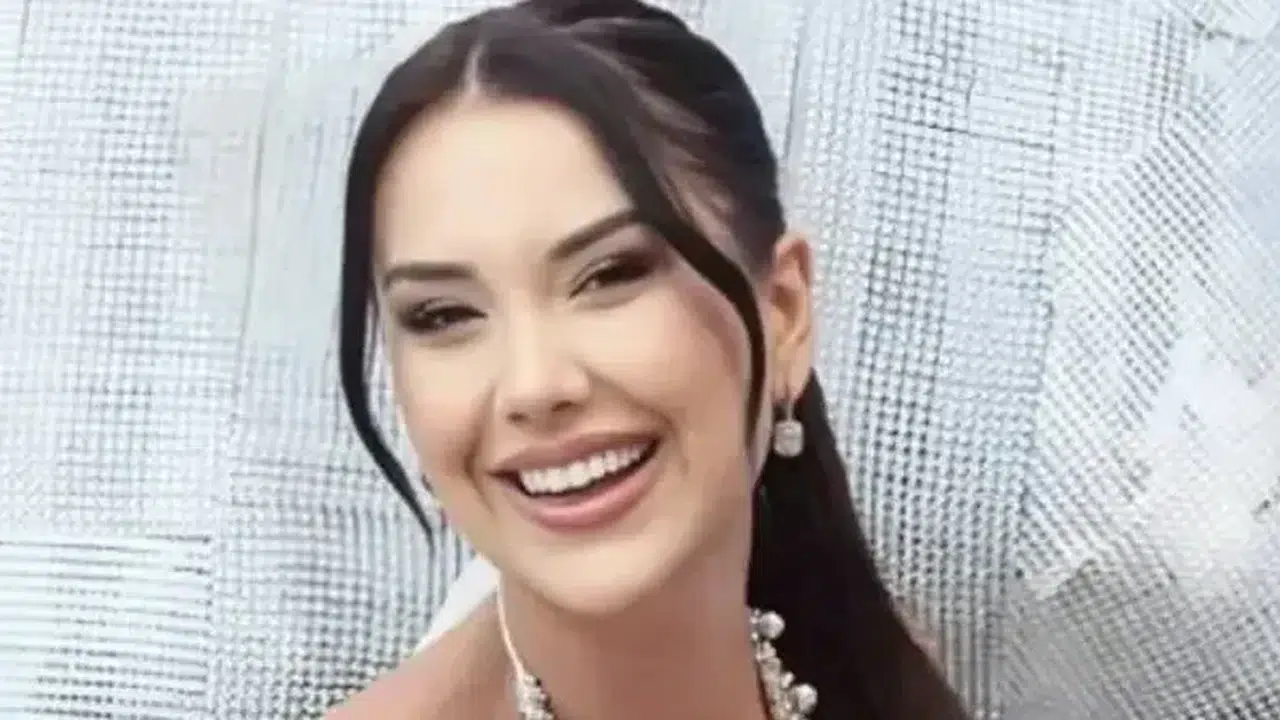 DİLAN POLAT ESKİ HALİ NASIL? Estetik öncesi görüntüsü ile şimdiki hali arasındaki farklar neler?