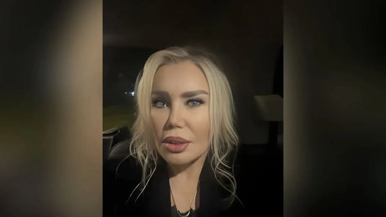 ESİN DEMİRÖREN ESTETİKSİZ HALİ VE SON HALİ!