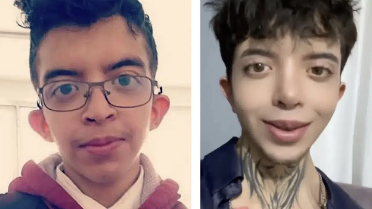 Tablet Reis’in Estetik Sonrası Görünümü Sosyal Medyada Olay Yarattı