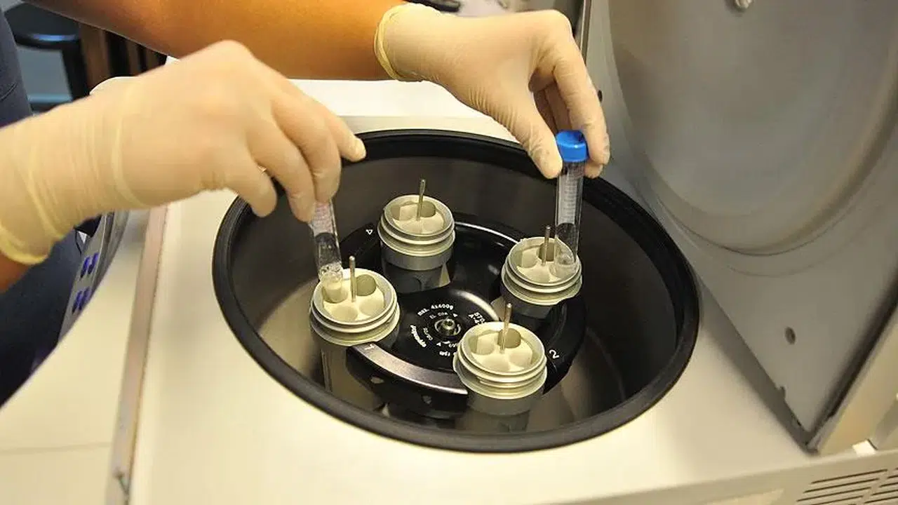 Tüp bebek nedir, başarı oranı kaçtır?