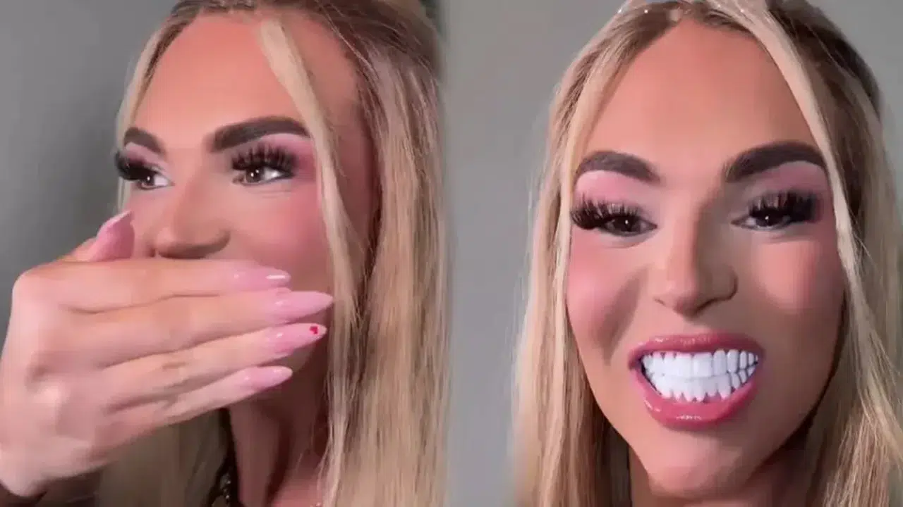 890 Bin TL’lik Diş Estetiği Sosyal Medyayı Karıştırdı! Yorum Yağdı