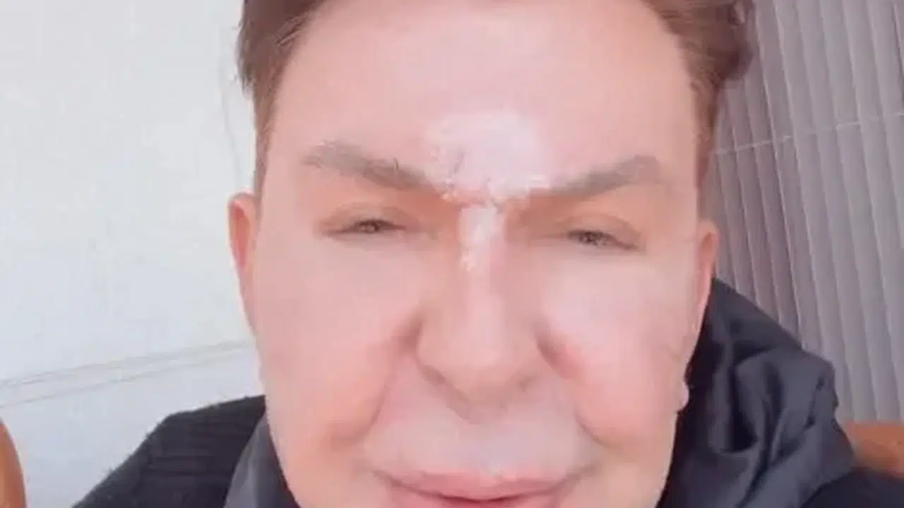 Estetik pişmanlığını bıçak altına yatarak sildi! İşte Kuşum Aydın’ın inanılmaz dönüşümü