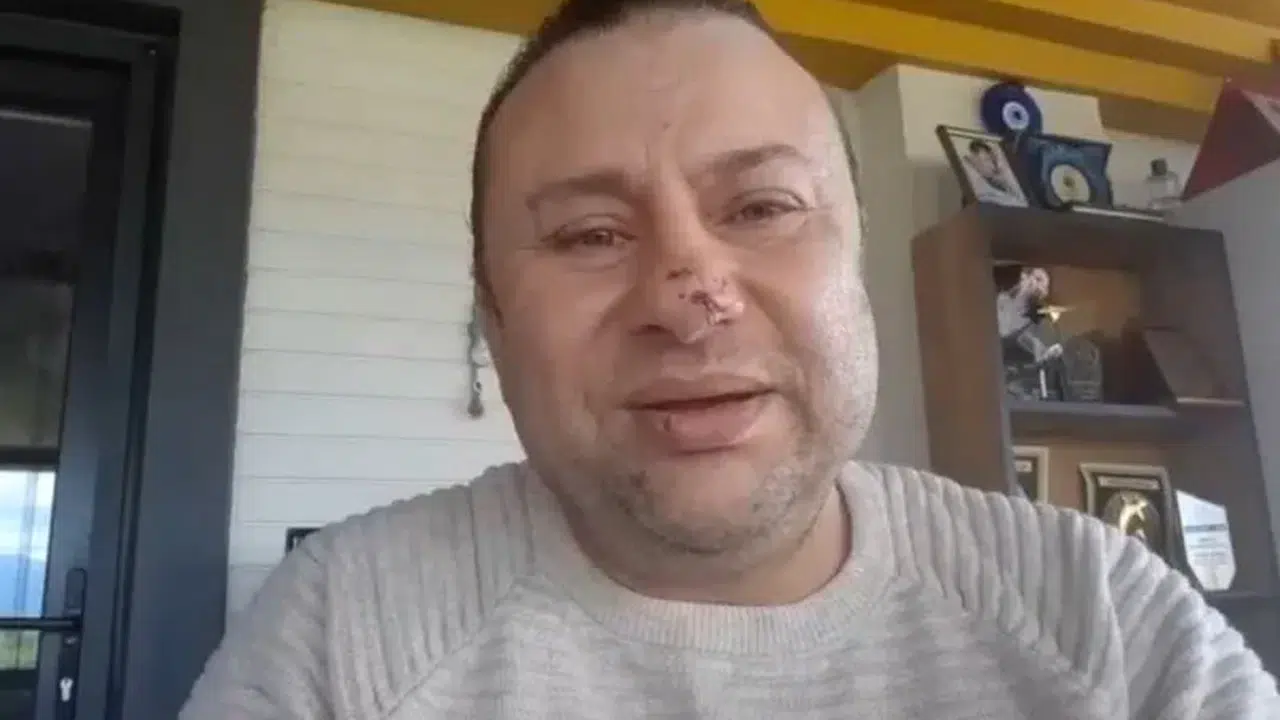 Onur Akay ölümün kıyısından döndü: Pitbull dehşeti sonrası entübe edildi!