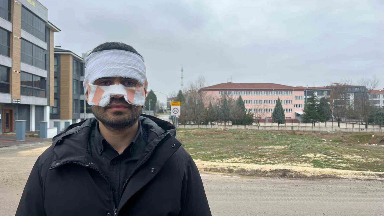 Rehber öğretmenin yüzüne sıcak çay fırlattığı fizik öğretmeni feci şekilde yandı