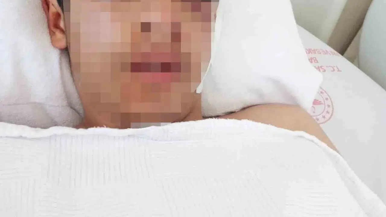 Sadece şaka yapma dediği için dehşeti yaşadı: 15 yaşındaki çocuğun yüzünde kalıcı hasar bıraktılar