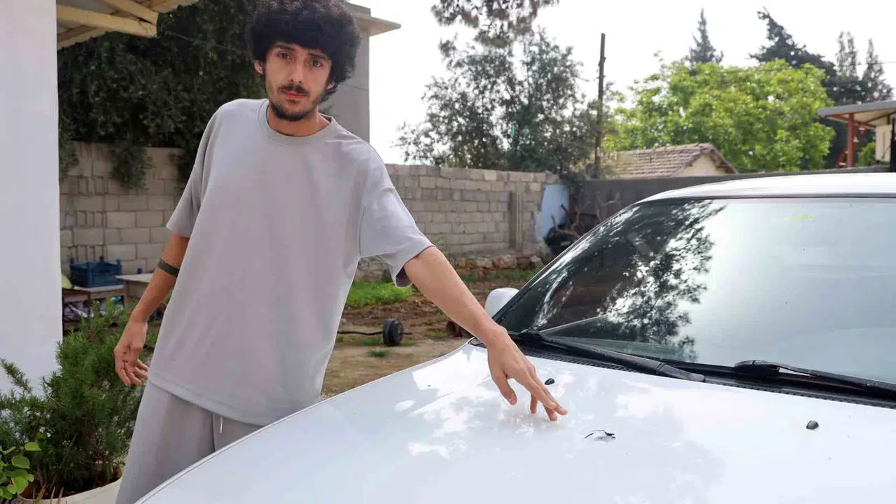 Bahçede huzurla otururken kabusu yaşadı: Kendi evinin önünde ölümden döndü