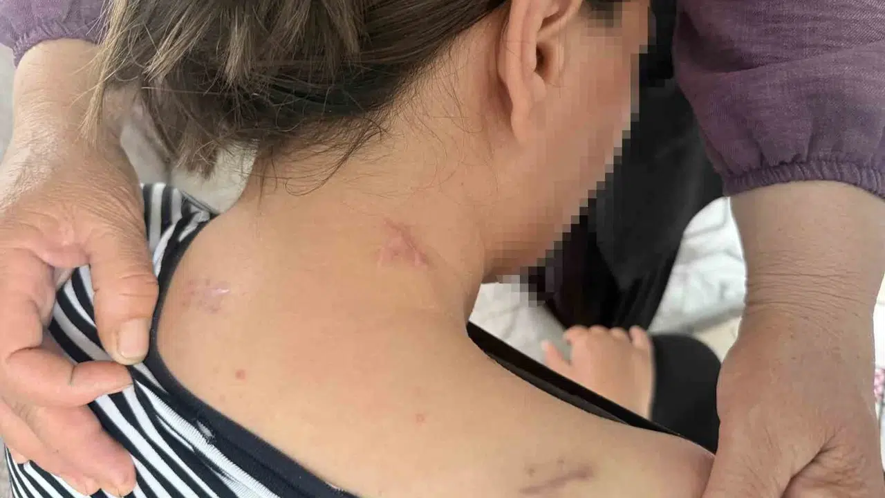 17 bıçak darbesiyle yaşam mücadelesi verdi: Ölü taklidi yaparak katilinden kurtuldu