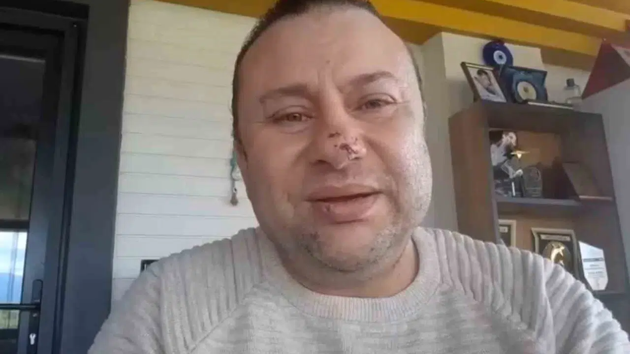 Pitbull dehşeti ölümün kıyısına getirdi: Onur Akay yaşadığı kabusu anlattı