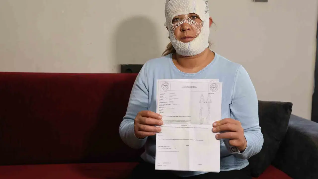 Güzellik hayali kabusa döndü: Prenses bakımı yaptırdı, yüzü tanınmaz hale geldi