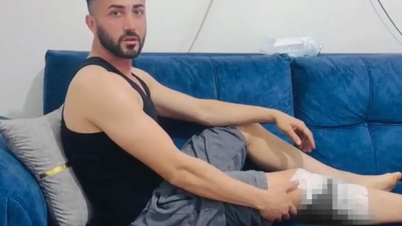 Nizip’te dehşet anları: Sokak ortasında köpeklerin hedefi oldular, belediyeye ateş püskürdüler