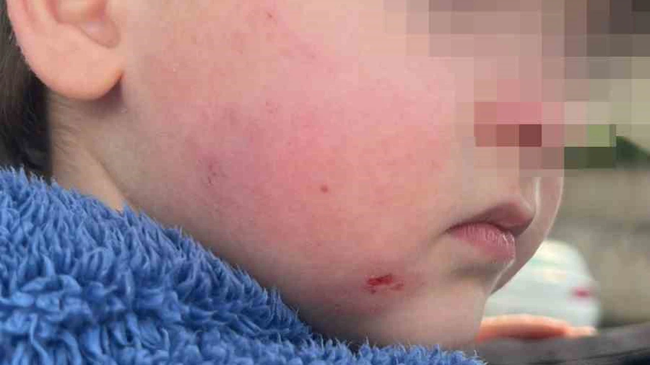 Kreşe bıraktığı çocuğunu darp edilmiş halde aldı