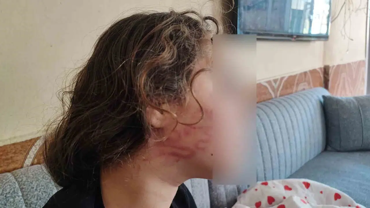 Adana'da Çocuk Kavgası Kanlı Bitti: Öfkesini 11 Yaşındaki Epilepsi Hastası Kızdan Çıkardı