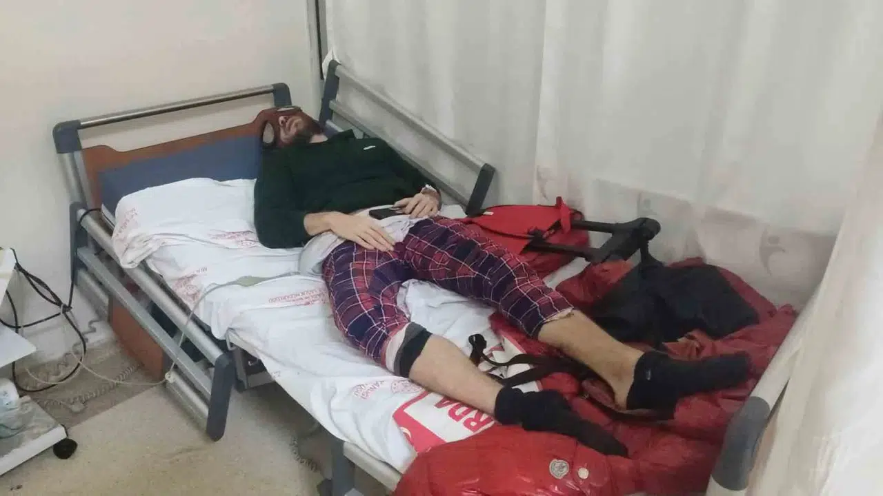 Sokakların Örümcek Adamı'na şaka pahalıya patladı: Yılan otu hastanelik etti