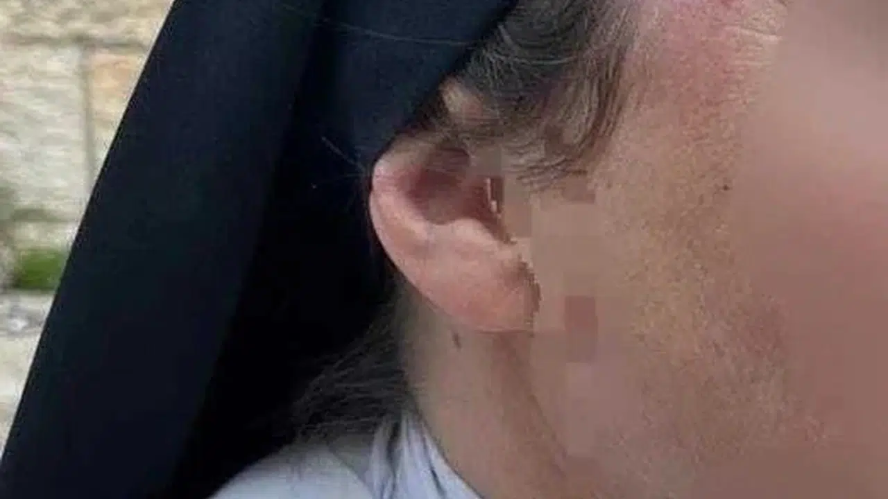 Kudüs'te kutsal topraklara çirkin saldırı: Rahibeyi darbeden şüpheli yakalandı