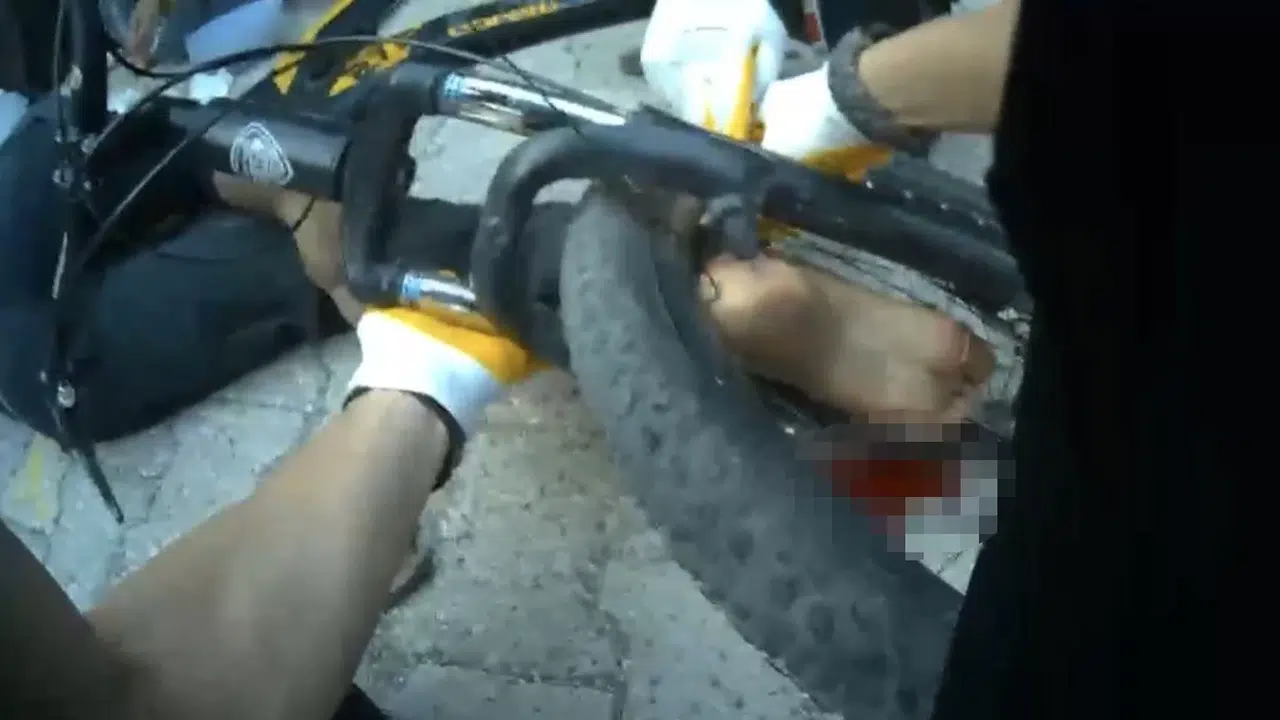 Osmaniye'de korku dolu anlar: Bisiklet sürerken ayağı tekerleğe dolanan çocuk hastanelik oldu