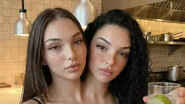 Valeria & Camila gerçek mi, yapay zeka mı? Instagram’daki yapışık ikizler hakkındaki iddialar