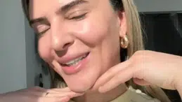 Survivor Merve Aydın’ın estetik paylaşımı olay oldu! 'Kimseyi kandıramazsın' yorumları yağdı