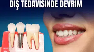 Diş tedavisinde yeni dönem: İmplant masraflarını SSK karşılayacak! İşte şartları