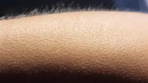 Tüylerimiz neden diken diken olur, ürpermek neyin belirtisi? Duygular ve vücut direnci arasındaki bağ