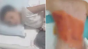 Akran zorbalığı dehşete dönüştü: Oyun dediler, diri diri yaktılar!
