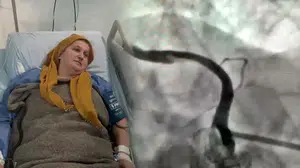 Zatürre kaynaklı şiddetli öksürük kalp damarını yırttı