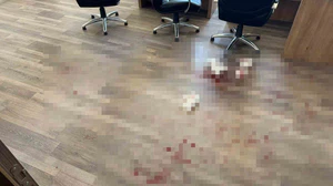 Yozgat’ta okul müdürünü darbeden saldırgan tutuklandı