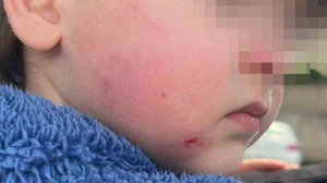 Kreşe bıraktığı çocuğunu darp edilmiş halde aldı