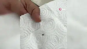 Siirt'te kene ısıran vatandaş hastaneye başvurdu