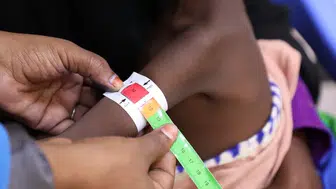 Somali'de insani yardım krizinde korkutan tablo: En ağır bedeli çocuklar ödüyo