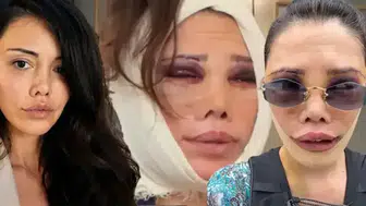 Survivor Didem Ceran Kore'deki kabusu Bali'de bıraktı: Aynı bedenle girdim ama aynı ruhla çıkmadım
