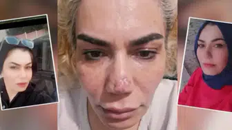 'Hiçbir şey yapamazsınız' dediler! 4 kez bıçak altına yatan kadının hukuk savaşı