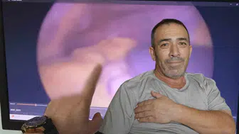 Doktor "Senin kalbin mi yok?" dedi: 54 yıl boyunca dev gerçeği bilmeden yaşadı