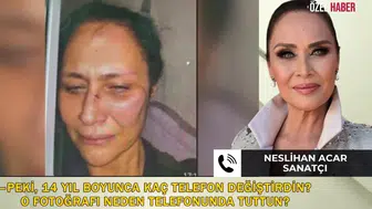 Neslihan Acar’a şiddet iddiası ne, fotoğraf neden 14 yıl sonra gönderildi, Levent İnanır ne dedi?